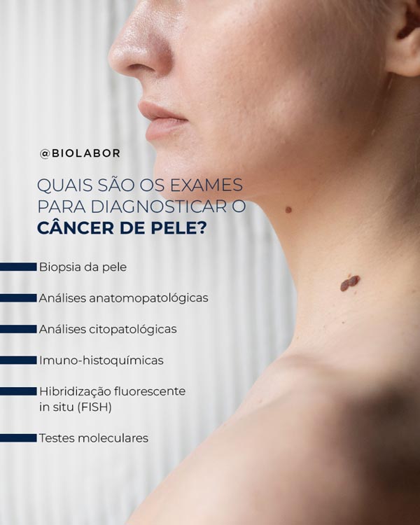 exames-cancer-pele